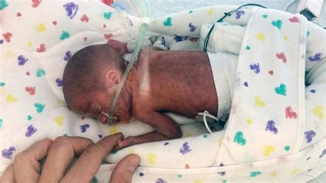 Pound Baby Born Early Aboard Cruise Ship Survives Health News Florida