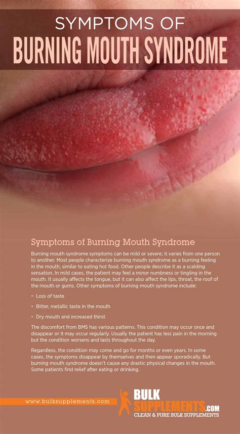 Tablo Read Burning Mouth Syndrome Bms Symptoms Causes