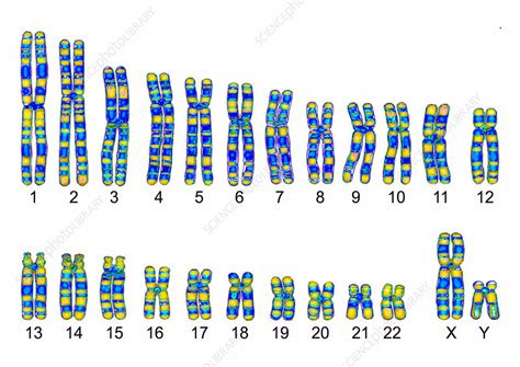 Human Karyotype Stock Image C013 0007 Science Photo Library