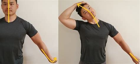 Exercises For A Pinched Nerve In The Neck Posture Direct