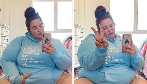 Why Body Positivity Doesnt Actually Promote Obesity