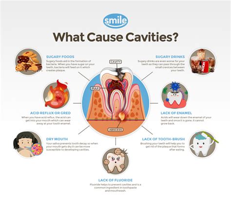 Pediatric Dentistry What Are The Causes Of Cavities