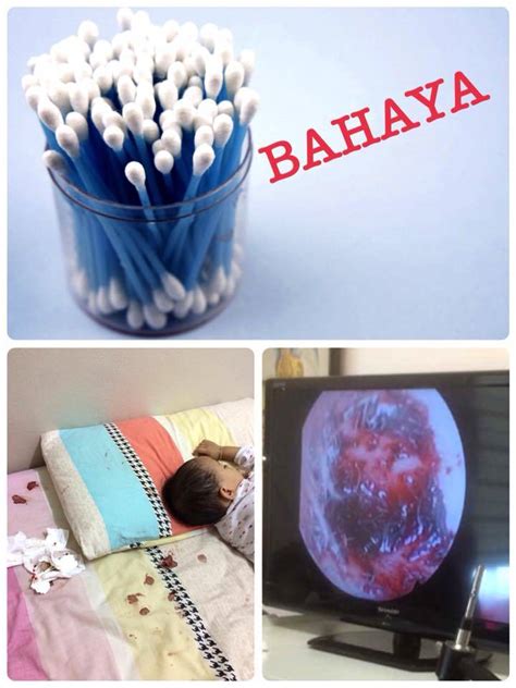 Banyak ni je yang aku ada. Tak Sedar Anak Guna Cotton Bud Korek Telinga Sampai ...
