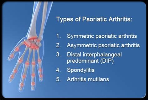 Symptoms Causes And Treatment Of Psoriatic Arthritis