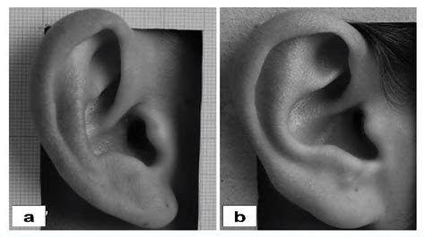 Two Images Of Right Auricle Download Scientific Diagram