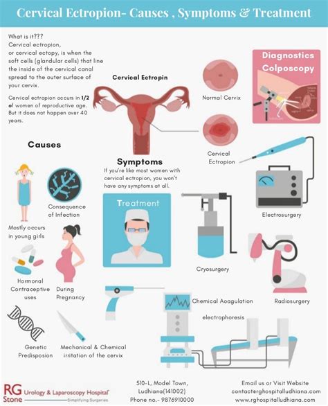 Cervical Ectropion Causes Symptoms And Treatment