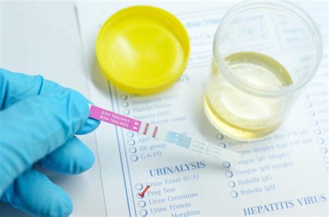Hospital Pregnancy Test Results Livestrongcom