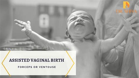 Assisted Vaginal Birth Forceps Or Ventouse Blog Dr Shiva