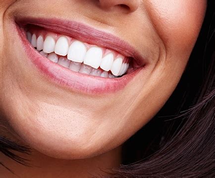 Cosmetic Dentistry Baltimore MD Porcelain Veneers Teeth Whitening