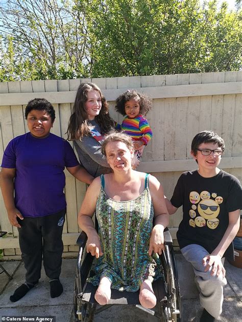 Mum Of Four Who Needed Both Legs Amputating After A House Fire Claims Accident
