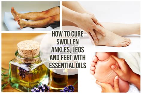 How To Cure Swollen Ankles Legs And Feet With Essential Oils