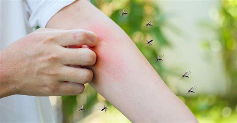 Alergia A Picadas De Inseto Cuidados Para Se Proteger