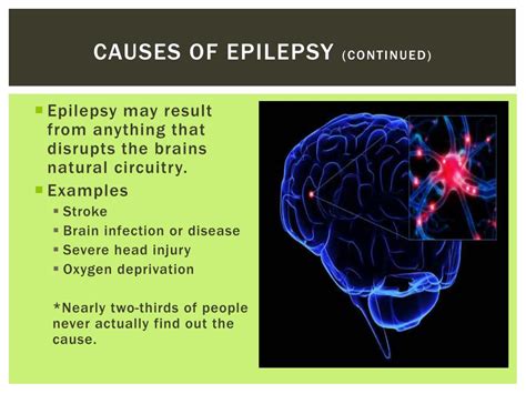 Ppt Epilepsy Powerpoint Presentation Free Download Id