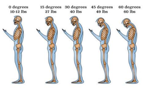 posture matters clearview chiropractic