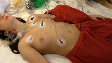Ekg Lead Placement On Baby Hot Sex Picture