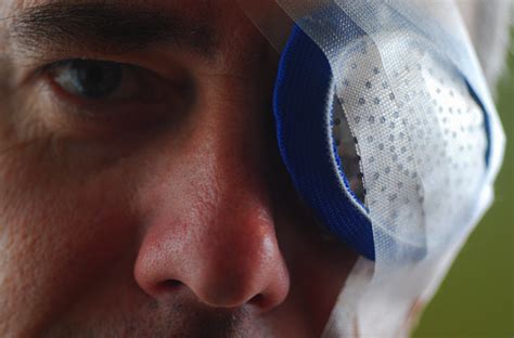 Apr 12, 2021 · without insurance, the cost of cataract surgery on both eyes is upwards of $6,000 to $12,000. Cataract Surgery Recovery