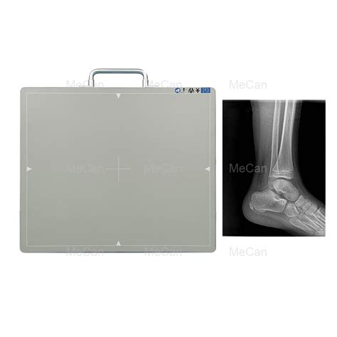 Wireless Dr X Ray Podiatry Digital X Ray Flat Panel Detector China Dr