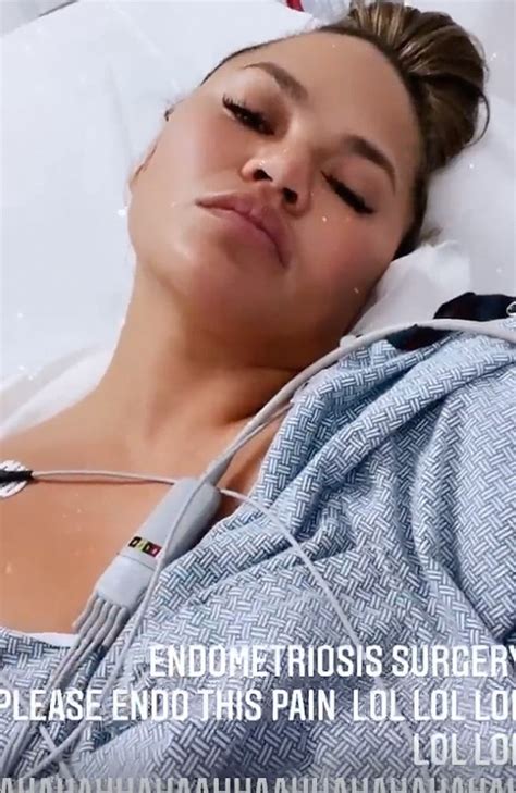 Chrissy Teigen Shares Instagram Photo Of Surgery Scars After Breast Implant Removal The Advertiser