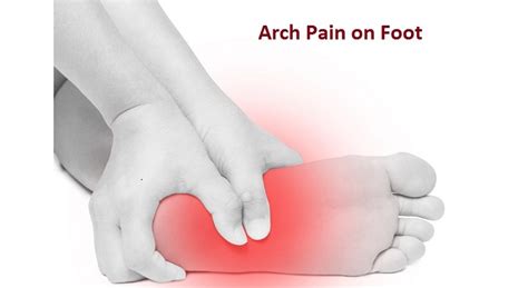 Arch Pain On Foot Symptoms Causes And Treatment Plan