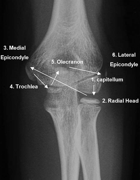Ossification Of The Elbow Radiology Student Medical Radiography