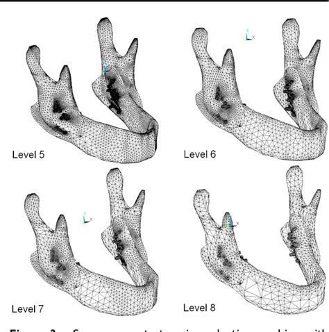 Figure From Biomechanical Stability Analysis Of Rigid Intraoral