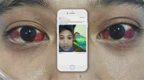 Your Eyes Cant Burst From Looking At Your Phone