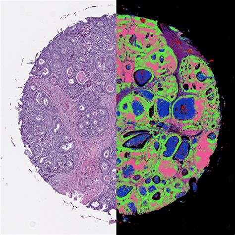 Stainless Imaging Developed By Adding Infrared To Standard Microscopes