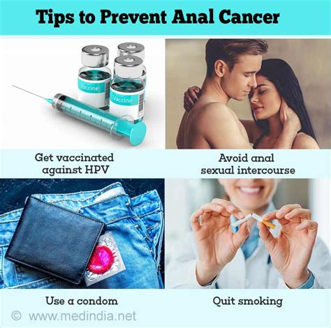 Anal Cancer Cancer Of Anal Causes Symptoms Staging Treatment Prognosis And Prevention