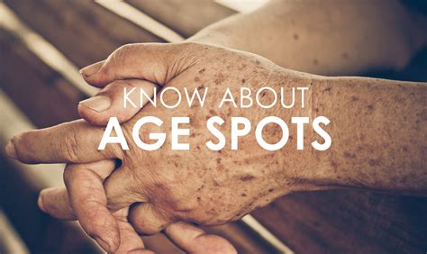 Age Spots On The Face Causes And Symptoms Premier Clinic