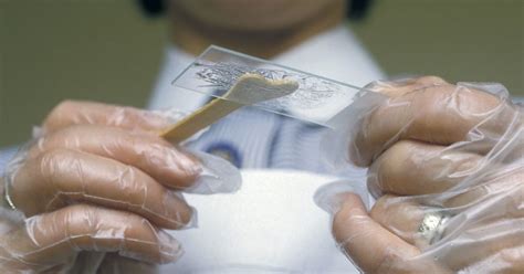 To do this, a small piece. SHARE Free Pap Smear At LPPKN Clinics Nationwide Until ...