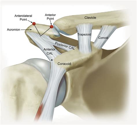 Schematic Representation Of The Coracoacromial Ligament Cal