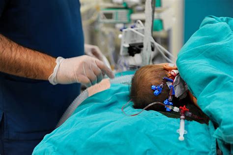 310 Pediatric Anesthesia Stock Photos Pictures And Royalty Free Images