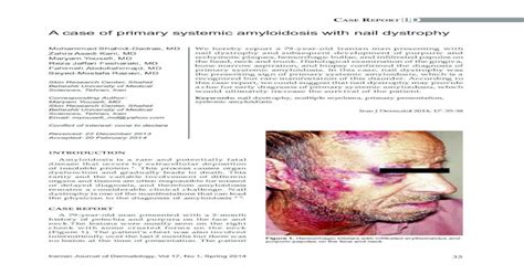 A Case Of Primary Systemic Amyloidosis With Nail · Pdf File Systemic