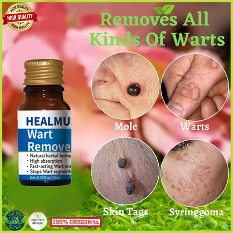 100 Effective Warts Remover Original Herpes Original Warts Removal