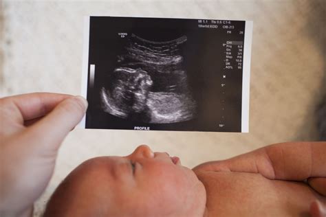 Boy Ultrasound At 14 Weeks Hiccups Pregnancy