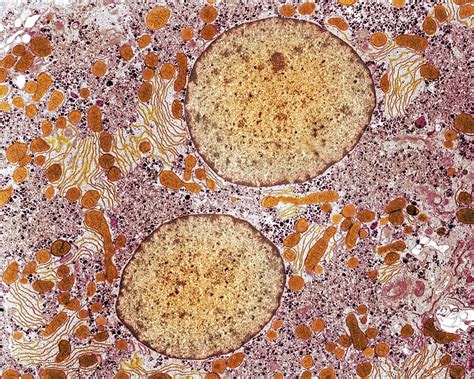 Liver Cell Tem Stock Image P5300187 Science Photo Library
