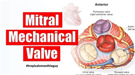 How Heart Valve Replacement Works Through Mitral Mechanical