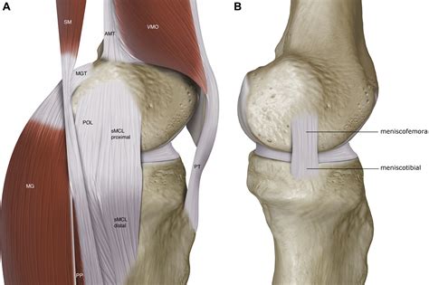 Surgical Repair Of Medial Collateral Ligament And Posteromedial Corner