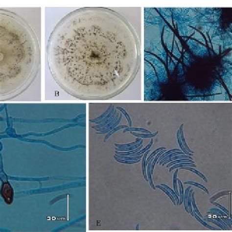 Morphology Of The Isolate Colletotrichum Musae Scua Hey 8 A And B