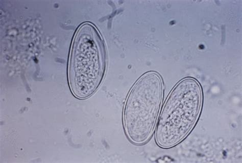 Huevos de Enterobius vermicularis Microbiología Protozoos Nematodos