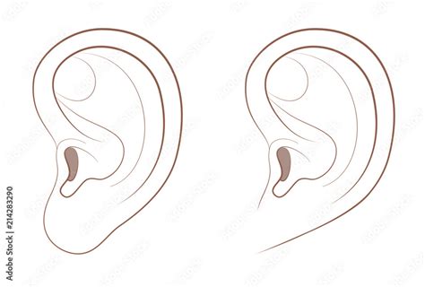 Free Earlobe And Attached Earlobe In Comparison Different Appearance