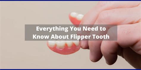 Everything You Need To Know About Flipper Tooth Ihome Dental