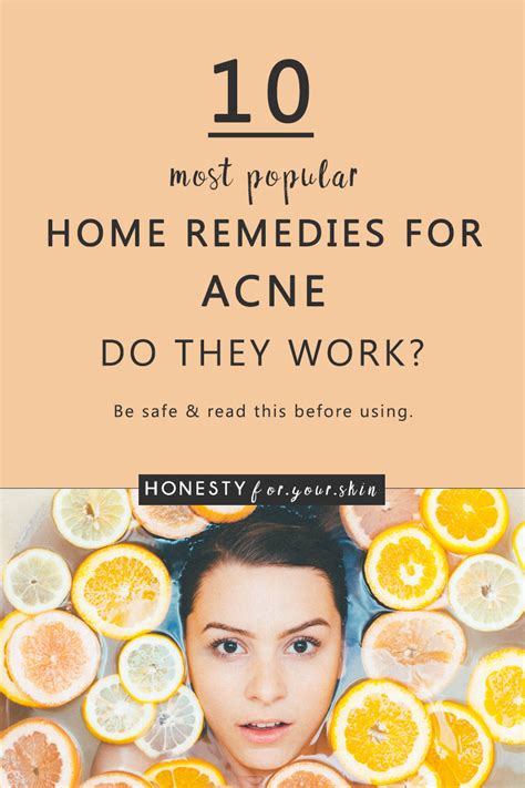 10 Most Popular Home Remedies For Acne Do They Work Honesty For