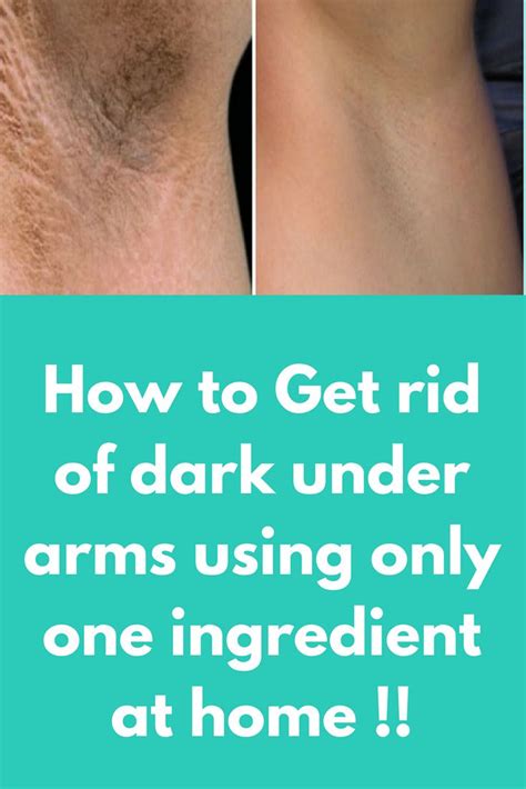 However, sometimes it can turn a bit darker, and this can lead to a all rights reserved. One week challenge to Get rid of dark under arms using ...