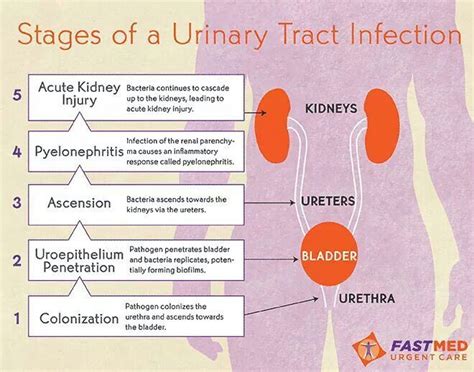 Stages Of Urinary Tract Infections Its Best To Have Herbs On Hand When Onset Occurs To Avoid
