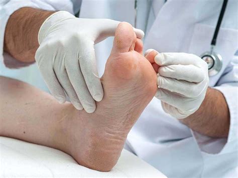 Top 4 Effective Athletes Foot Treatments In Scottsdale