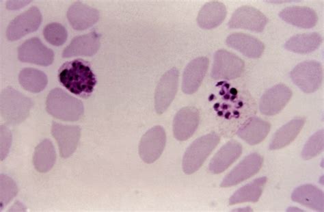 Kostenlose Bild Mikroskopische Aufnahme Wachsen Plasmodium Vivax Trophozoite