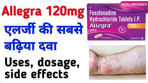 Allegra 120 Mg Tablet Use Dose Benefits And Side Effects Full Review In