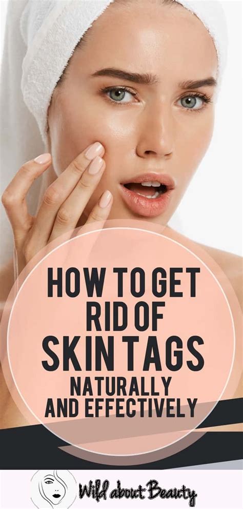 how to get rid of skin tags naturally and effectively