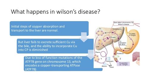 Wilsons Disease Wilson
